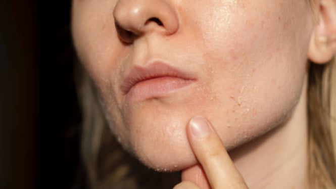 kulit-kering-dan-bersisik-ini-kandungan-wajib-di-moisturizer-agar-tetap-lembap-sepanjang-hari_7dfc5f9.jpg